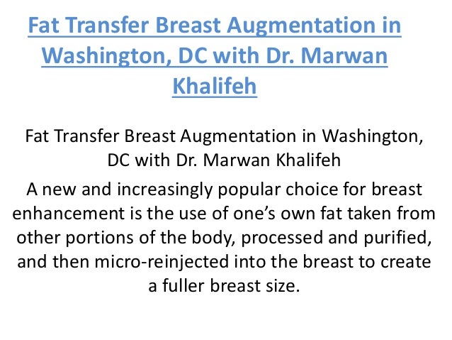 breast augmentation dc area Breast augmentation dc area